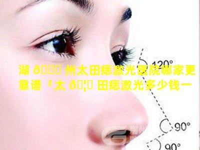 湖 🍀 州太田痣激光医院哪家更靠谱「太 🦄 田痣激光多少钱一平方厘米」